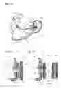 Fig. 18 - Facial structure stabilization methods and apparatus