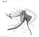 Fig. 19 - Facial structure stabilization methods and apparatus
