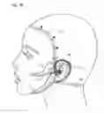Fig. 20 - Facial structure stabilization methods and apparatus