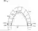 Fig. 01 - FOOD OBSTRUCTING DENTAL DEVICE