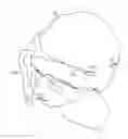 Fig. 01 - Head cover having selectable size and location of opening for exposure of a portion of a user's hair