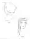 Fig. 02 - Head cover having selectable size and location of opening for exposure of a portion of a user's hair