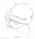 Fig. 03 - Head cover having selectable size and location of opening for exposure of a portion of a user's hair
