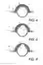 Fig. 04 - Pipe and conduit wear detection system