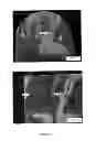 Fig. 02 - METHOD OF CLADDING AND FUSION WELDING OF SUPERALLOYS