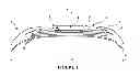 Fig. 02 - Crown for an aircraft tire