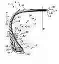 Fig. 01 - KIT AND METHOD FOR THE TEMPORARY ATTACHMENT OF AN ELECTRONIC DEVICE TO A SUPPORT OF A TYRE CASING