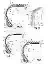 Fig. 03 - KIT AND METHOD FOR THE TEMPORARY ATTACHMENT OF AN ELECTRONIC DEVICE TO A SUPPORT OF A TYRE CASING