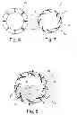 Fig. 04 - Friction clutch with readjustment device