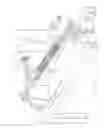 Fig. 03 - Induction heating of springs