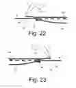 Fig. 11 - Beverage Can Having Deflecting Closure Element