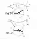 Fig. 26 - Beverage Can Having Deflecting Closure Element