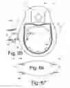 Fig. 29 - Beverage Can Having Deflecting Closure Element