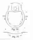 Fig. 31 - Beverage Can Having Deflecting Closure Element