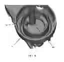 Fig. 16 - Dip tube connectors and pump systems using the same