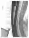 Fig. 08 - Utility belt assembly