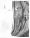 Fig. 11 - Utility belt assembly