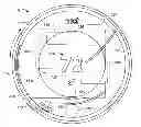Fig. 01 - Round thermostat with rotatable user input member and temperature sensing element disposed in physical communication with a front thermostat cover