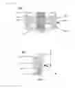 Fig. 11 - Fuel injection valve