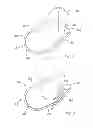 Fig. 05 - Drop in loop hanger