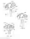 Fig. 04 - Washing machine suspension ball support