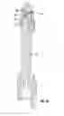 Fig. 23 - Transverse handle assembly for a valve