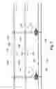 Fig. 04 - SUPPORT APPARATUS FOR BARRIER MEANS AND METHOD OF USE THEREOF