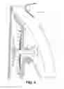 Fig. 04 - Vehicle pillar trim assembly