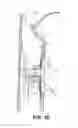 Fig. 09 - Vehicle pillar trim assembly