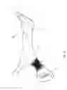 Fig. 09 - Hand strap for a skiing pole or similar