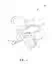 Fig. 05 - Child high chair