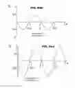 Fig. 18 - HIGH EFFICIENCY ACCEL/DECEL SERVO DEVICE AND SYSTEM