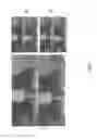 Fig. 09 - Method and device for generating, storing, transmitting, receiving and reproducing depth maps by using the color components of an image belonging to a three-dimensional video stream