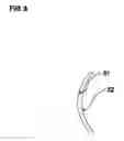 Fig. 06 - Methods and devices for refractive correction of eyes