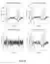 Fig. 08 - Hearing assistance device with brain computer interface