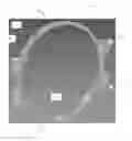 Fig. 01 - Guard for a rotary pump