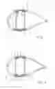 Fig. 03 - COMPOSITE FIBRE COMPONENT FOR A ROTOR BLADE, DEVICE FOR MANUFACTURING A COMPOSITE FIBRE COMPONENT FOR A ROTOR BLADE AND THE METHOD FOR MANUFACTURING A COMPOSITE FIBRE COMPONENT FOR A ROTOR BLADE