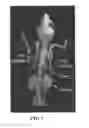 Fig. 04 - PSMA-binding agents and uses thereof