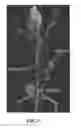 Fig. 06 - PSMA-binding agents and uses thereof