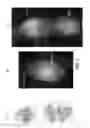 Fig. 05 - dsRNA/DNA Hybrid Genome Replication Intermediate Of Metakaryotic Stem Cells