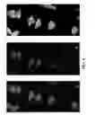 Fig. 09 - dsRNA/DNA Hybrid Genome Replication Intermediate Of Metakaryotic Stem Cells