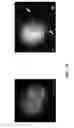 Fig. 11 - dsRNA/DNA Hybrid Genome Replication Intermediate Of Metakaryotic Stem Cells