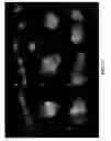 Fig. 14 - dsRNA/DNA Hybrid Genome Replication Intermediate Of Metakaryotic Stem Cells