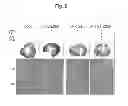Fig. 10 - Liposome composite body