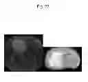 Fig. 23 - Liposome composite body
