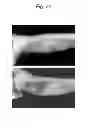 Fig. 25 - Liposome composite body