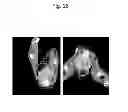 Fig. 27 - Liposome composite body