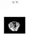Fig. 31 - Liposome composite body