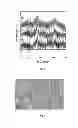 Fig. 02 - Curcumin coated magnetite nanoparticles for biomedical applications