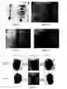 Fig. 06 - Biodegradable medical adhesive and preparation method and use thereof